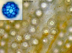 Asci und Sporen in Wasser, einzelne Spore in CB, x1000