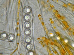 Asci, Sporen und Paraphysen in Wasser, x1000