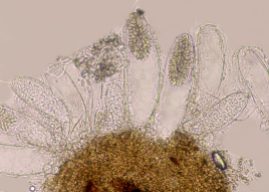 Hymenium mit Asci, Sporen und Paraphysen in Wasser, x200