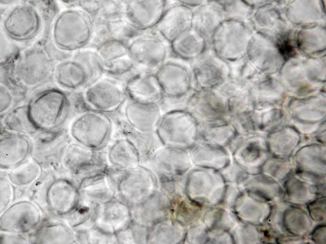 Exzipulum-Zellen in Wasser, x1000