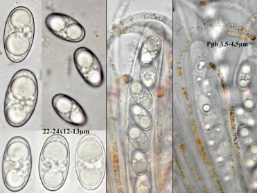 Asci, Sporen und Paraphyseni in Wasser, x1000