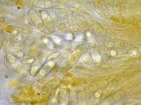 Asci und Sporen in Wasser, x400
