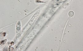 Spore und Paraphyse in Wasser, x1250