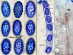 Collage mit Sporen und Ascus in CB, Paraphysen in Wasser, x1000